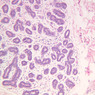 A93, Mammary Gland (Inactive), 10x (H&E)