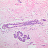 A93, Mammary Gland (Inactive), 10x (H&E)