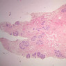 A93, Mammary Gland (Inactive), 1x (H&E)