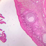 B96, Ovary, 2.5x (H&E)