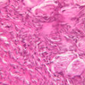 B96, Ovary, 40x (H&E)