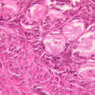 B96, Ovary, 40x (H&E)