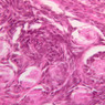 B96, Ovary, 40x (H&E)