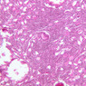 B94, Ovary, 10x (H&E)