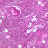 B94, Ovary, 20x (H&E)