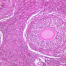 B94, Ovary, 20x (H&E)