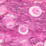 B96, Ovary, 40x (H&E)