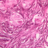 B96, Ovary, 40x (H&E)