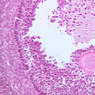 B94, Ovary, 20x (H&E)