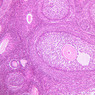 B94, Ovary, 10x (H&E)