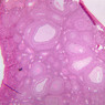B94, Ovary, 2.5x (H&E)