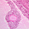 B96, Ovary, 20x (H&E)