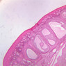 B96, Ovary, 2.5x (H&E)