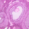 B94, Ovary, 10x (H&E)