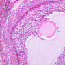 B94, Ovary, 20x (H&E)