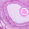 B94, Ovary, 20x (H&E)