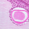 B94, Ovary, 40x (H&E)