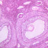 B94, Ovary, 10x (H&E)