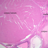B54, Ovary, 1x Labeled (H&E)