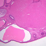 B54, Ovary, 1x (H&E)