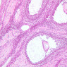 B95, Ovary, 10x (H&E)