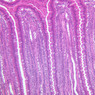B15, Jejunum, 10x (H&E)