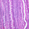B15, Jejunum, 20x (H&E)