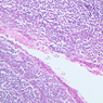 A41, Tonsil, 20x (Reticulin-H&E)