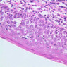 A41, Tonsil, 40x (Reticulin-H&E)