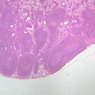 A32, Lymph Node, 2.5x (H&E)