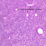 A32, Lymph Node, 40x Labeled (H&E)