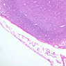 A32, Lymph Node, 10x (H&E)