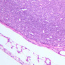 A32, Lymph Node, 20x (H&E)
