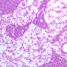 A32, Lymph Node, 20x (H&E)