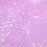 A32, Lymph Node, 10x (H&E)