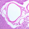 A32, Lymph Node, 20x (H&E)