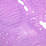 A32, Lymph Node, 10x (H&E)