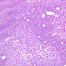 A32, Lymph Node, 20x (H&E)