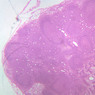 A32, Lymph Node, 2.5x (H&E)