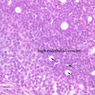 A32, Lymph Node, 40x Labeled (H&E)