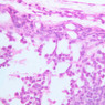 A32, Lymph Node, 40x (H&E)