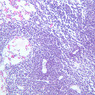 A33, Lymph Node, 10x (H&E)