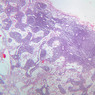 A33, Lymph Node, 2.5x (H&E)