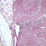 A34, Lymph Node, 10x (Reticulin)