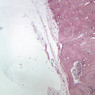 A34, Lymph Node, 2.5x (Reticulin)
