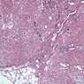 A34, Lymph Node, 10x (Reticulin)