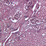 A34, Lymph Node, 20x (Reticulin)
