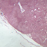 A34, Lymph Node, 2.5x (Reticulin)