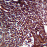 A34, Lymph Node, 20x (Reticulin)