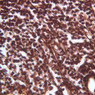 A34, Lymph Node, 40x (Reticulin)